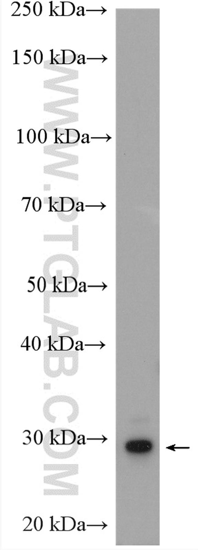 SCP3 Antibody in Western Blot (WB)