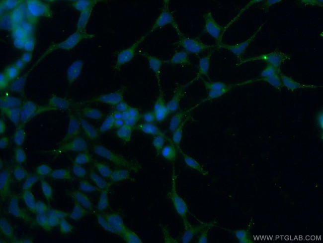 AKD1 Antibody in Immunocytochemistry (ICC/IF)