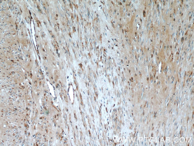 Oxytocin Receptor Antibody in Immunohistochemistry (Paraffin) (IHC (P))