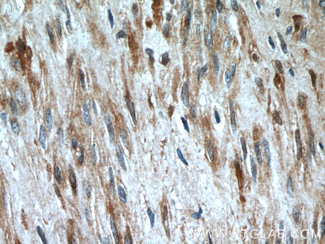 Oxytocin Receptor Antibody in Immunohistochemistry (Paraffin) (IHC (P))