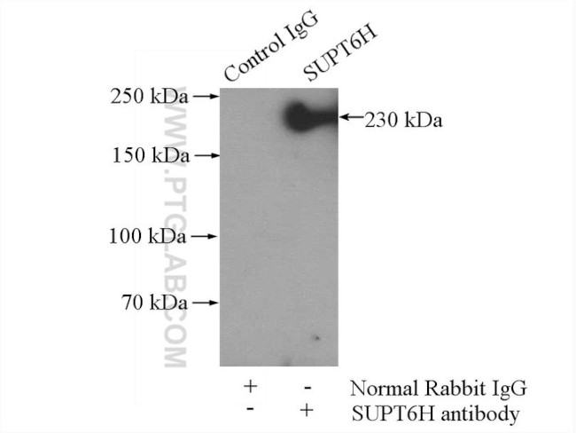 SUPT6H Antibody in Immunoprecipitation (IP)