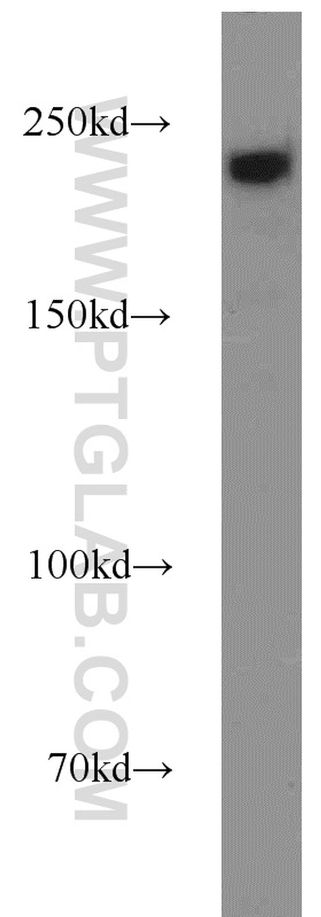 SUPT6H Antibody in Western Blot (WB)