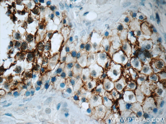 CD99 Antibody in Immunohistochemistry (Paraffin) (IHC (P))