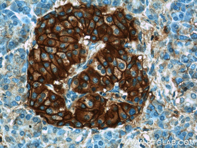 CD99 Antibody in Immunohistochemistry (Paraffin) (IHC (P))