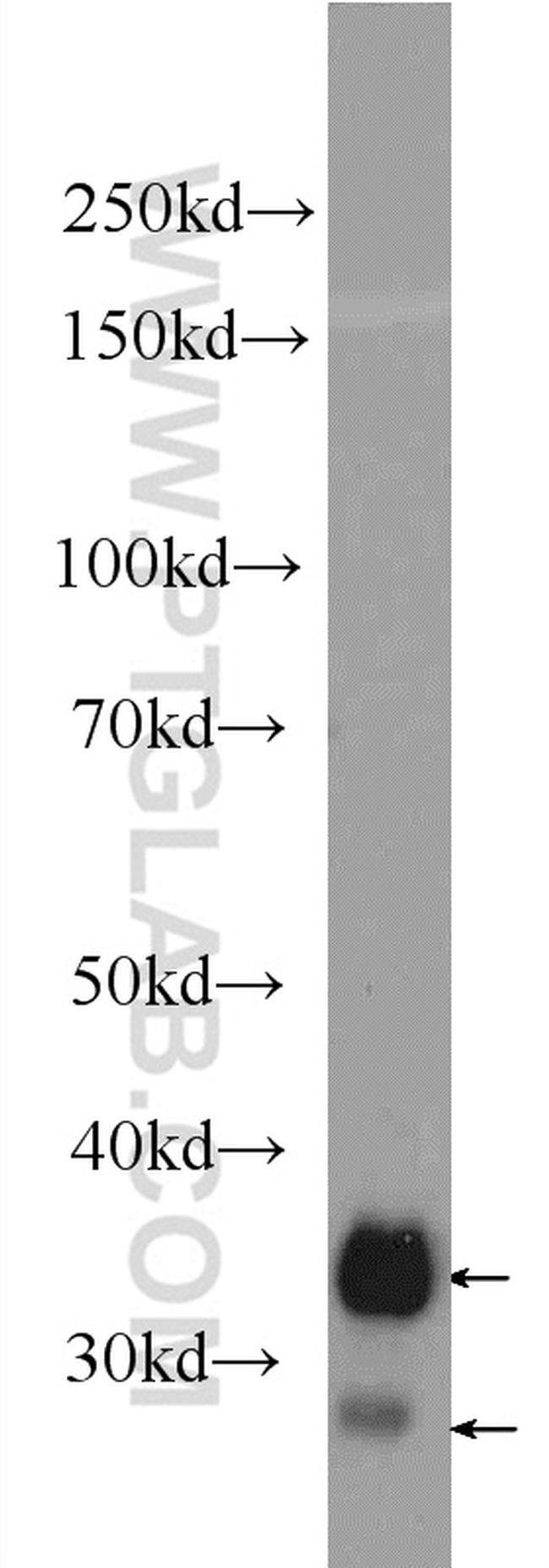 CD99 Antibody in Western Blot (WB)