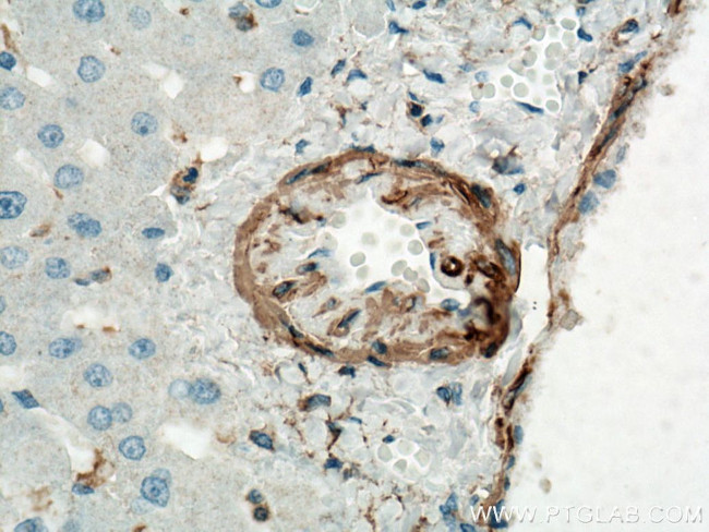 ACTA2/smooth muscle actin Antibody in Immunohistochemistry (Paraffin) (IHC (P))