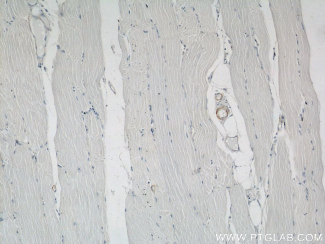 ACTA2/smooth muscle actin Antibody in Immunohistochemistry (Paraffin) (IHC (P))