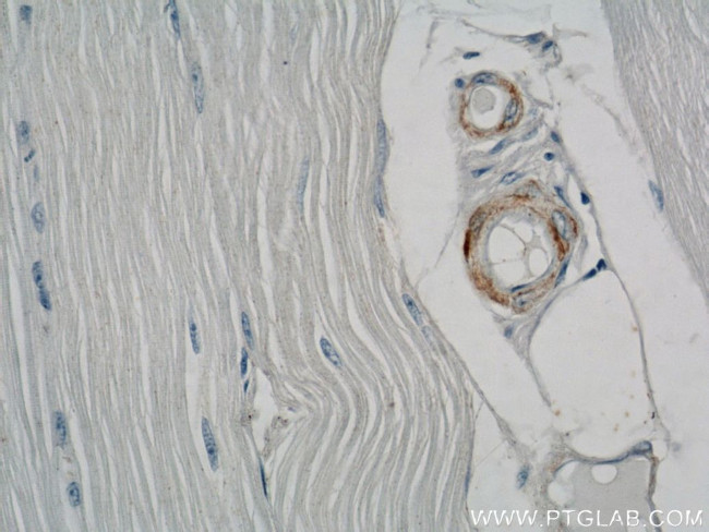 ACTA2/smooth muscle actin Antibody in Immunohistochemistry (Paraffin) (IHC (P))