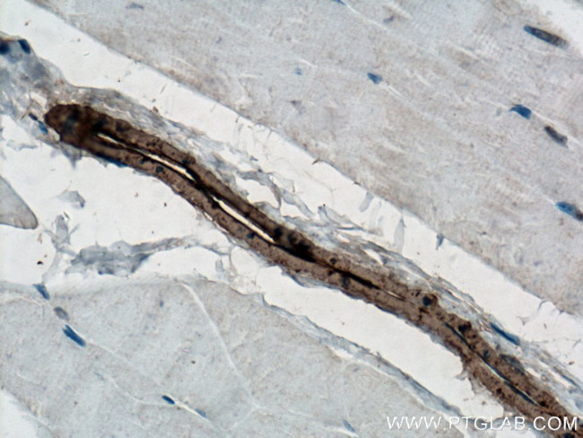 ACTA2/smooth muscle actin Antibody in Immunohistochemistry (Paraffin) (IHC (P))