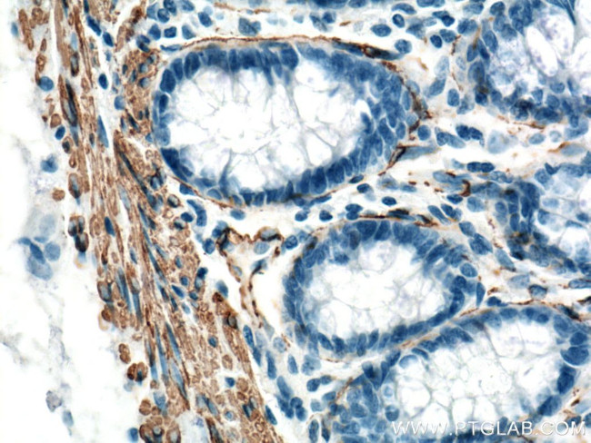 ACTA2/smooth muscle actin Antibody in Immunohistochemistry (Paraffin) (IHC (P))