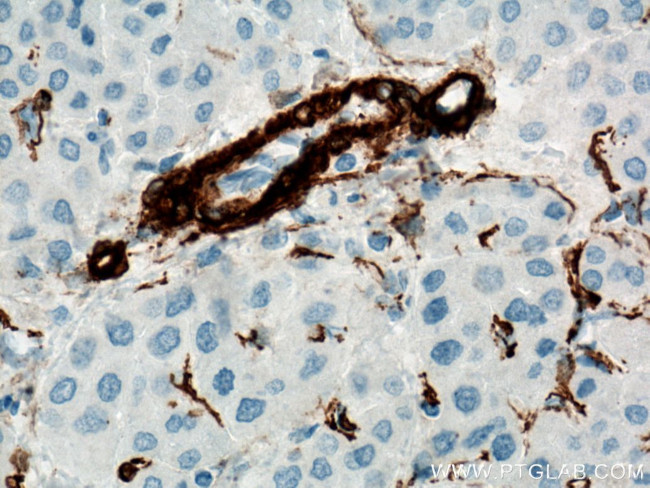 ACTA2/smooth muscle actin Antibody in Immunohistochemistry (Paraffin) (IHC (P))