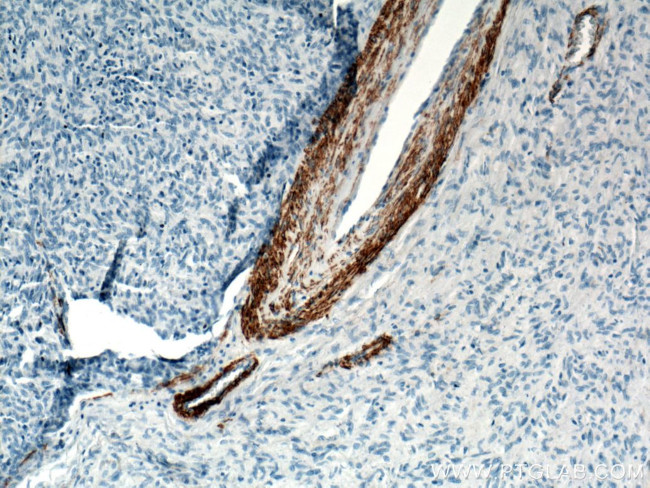 ACTA2/smooth muscle actin Antibody in Immunohistochemistry (Paraffin) (IHC (P))