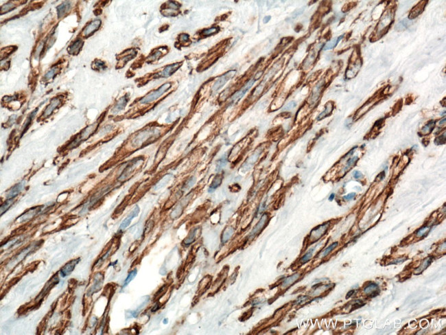 ACTA2/smooth muscle actin Antibody in Immunohistochemistry (Paraffin) (IHC (P))