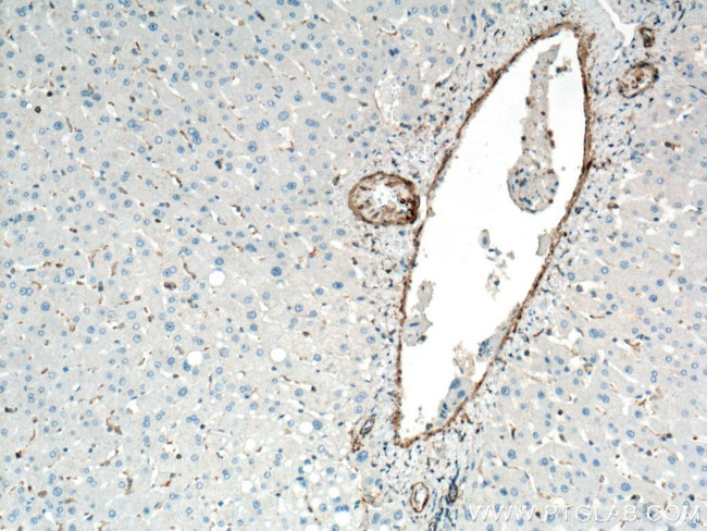 ACTA2/smooth muscle actin Antibody in Immunohistochemistry (Paraffin) (IHC (P))