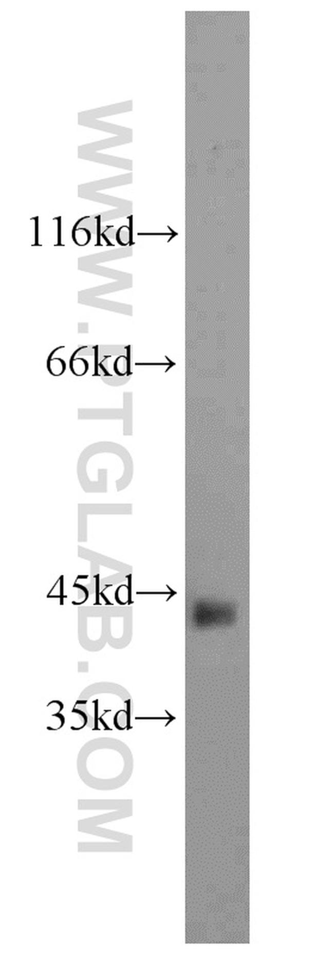 ACTA2/smooth muscle actin Antibody in Western Blot (WB)