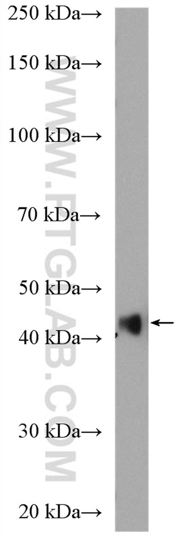 ACTA2/smooth muscle actin Antibody in Western Blot (WB)