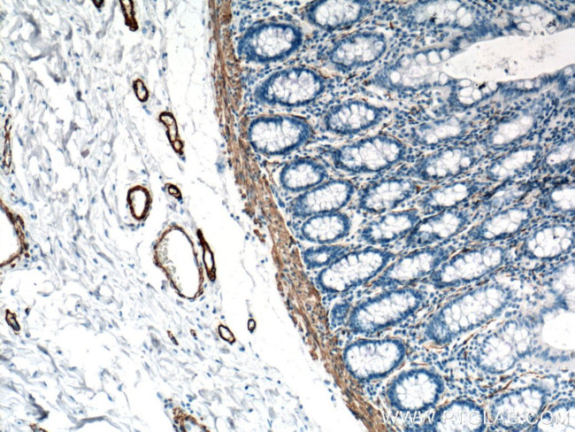 ACTA2/smooth muscle actin Antibody in Immunohistochemistry (Paraffin) (IHC (P))