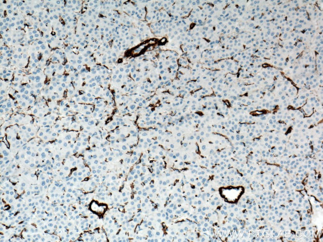 ACTA2/smooth muscle actin Antibody in Immunohistochemistry (Paraffin) (IHC (P))