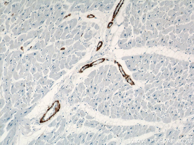 ACTA2/smooth muscle actin Antibody in Immunohistochemistry (Paraffin) (IHC (P))