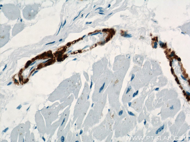 ACTA2/smooth muscle actin Antibody in Immunohistochemistry (Paraffin) (IHC (P))