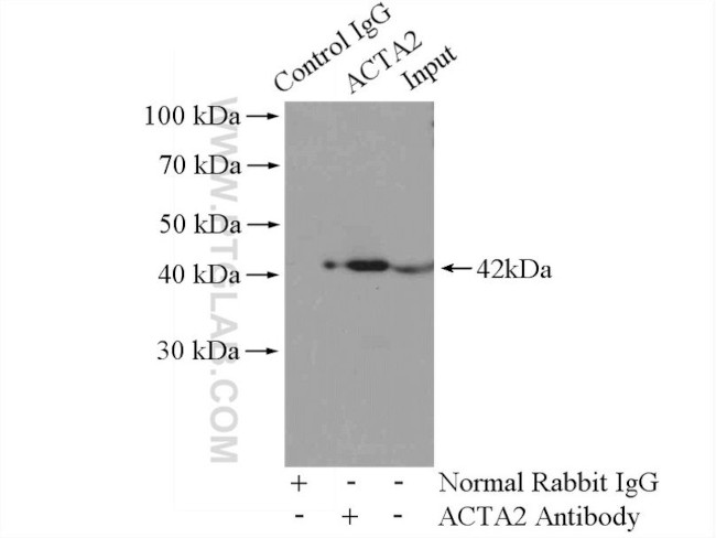 ACTA2/smooth muscle actin Antibody in Immunoprecipitation (IP)