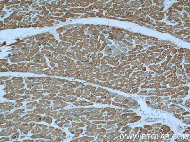 alpha Actin Antibody in Immunohistochemistry (Paraffin) (IHC (P))