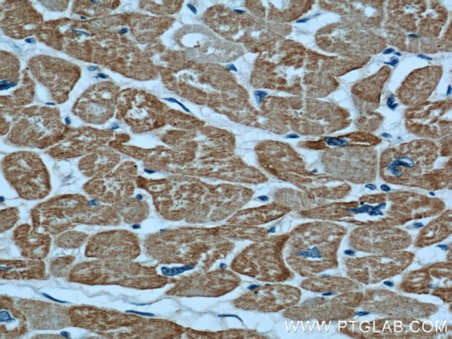 alpha Actin Antibody in Immunohistochemistry (Paraffin) (IHC (P))