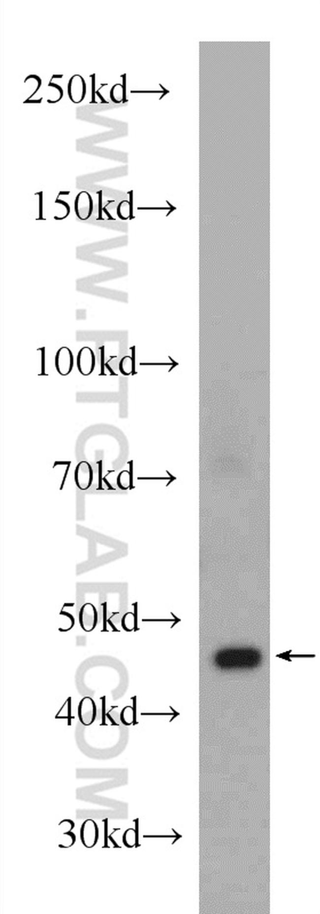 alpha Actin Antibody in Western Blot (WB)