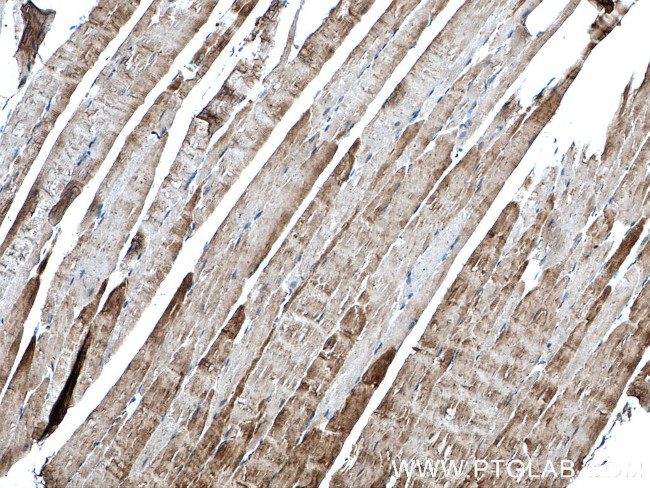 alpha Actin Antibody in Immunohistochemistry (Paraffin) (IHC (P))