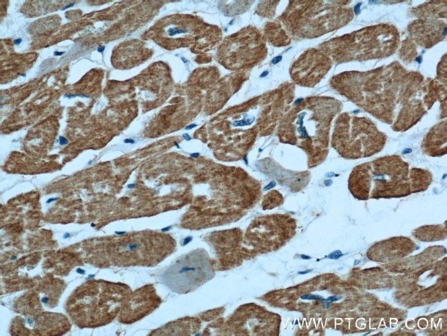 alpha Actin Antibody in Immunohistochemistry (Paraffin) (IHC (P))