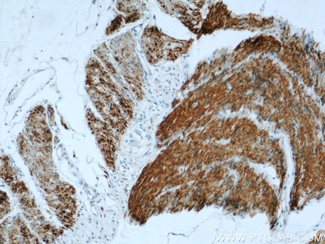 alpha Actin Antibody in Immunohistochemistry (Paraffin) (IHC (P))