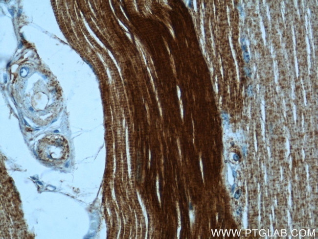 alpha Actin Antibody in Immunohistochemistry (Paraffin) (IHC (P))