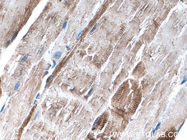 alpha Actin Antibody in Immunohistochemistry (Paraffin) (IHC (P))