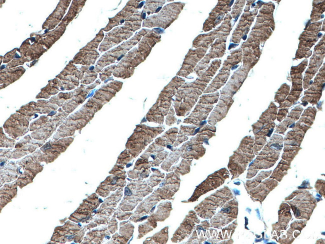 alpha Actin Antibody in Immunohistochemistry (Paraffin) (IHC (P))