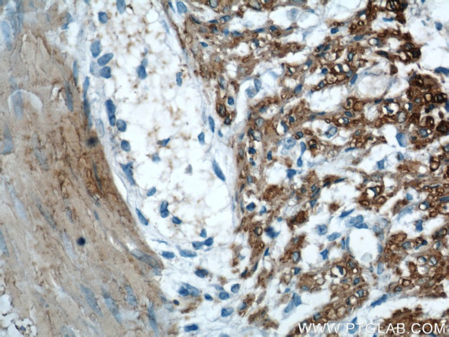 alpha Actin Antibody in Immunohistochemistry (Paraffin) (IHC (P))