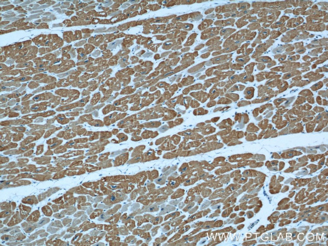 alpha Actin Antibody in Immunohistochemistry (Paraffin) (IHC (P))