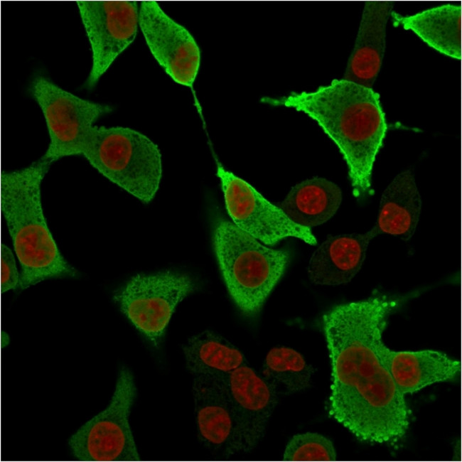 Aldo-keto Reductase Family 1 Member B1 Antibody in Immunocytochemistry (ICC/IF)