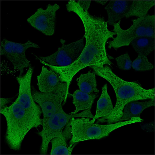 Aldo-keto Reductase Family 1 Member B1 Antibody in Immunocytochemistry (ICC/IF)