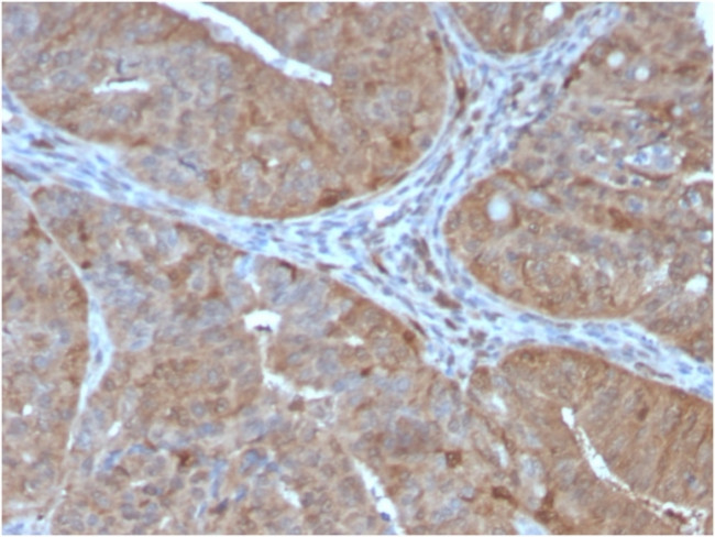 Aldo-keto Reductase Family 1 Member B1 Antibody in Immunohistochemistry (Paraffin) (IHC (P))