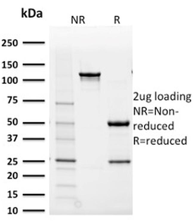 Aldo-keto Reductase Family 1 Member B1 Antibody in SDS-PAGE (SDS-PAGE)