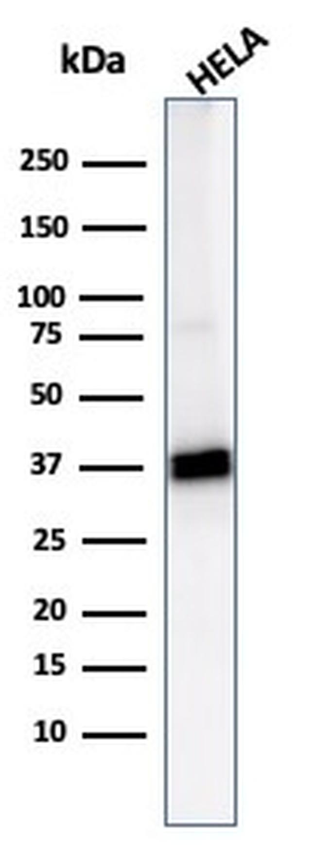 Aldo-keto Reductase Family 1 Member B1 Antibody in Western Blot (WB)