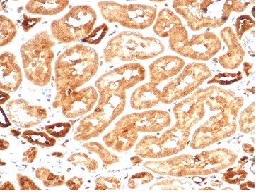 Aldo-keto Reductase Family 1 Member B1 (Adrenal Marker) Antibody in Immunohistochemistry (Paraffin) (IHC (P))