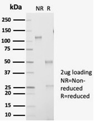 Aldo-keto Reductase Family 1 Member B1 (Adrenal Marker) Antibody in SDS-PAGE (SDS-PAGE)