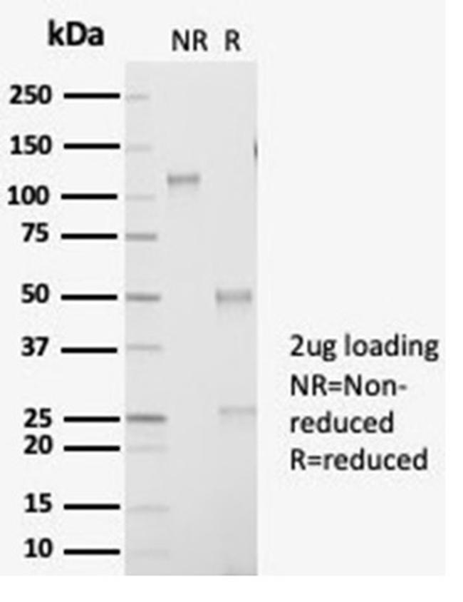 Aldo-keto Reductase Family 1 Member B1 (Adrenal Marker) Antibody in Immunoelectrophoresis (IE)