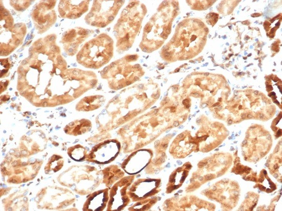 Aldo-keto Reductase Family 1 Member B1 (Adrenal Marker) Antibody in Immunohistochemistry (Paraffin) (IHC (P))