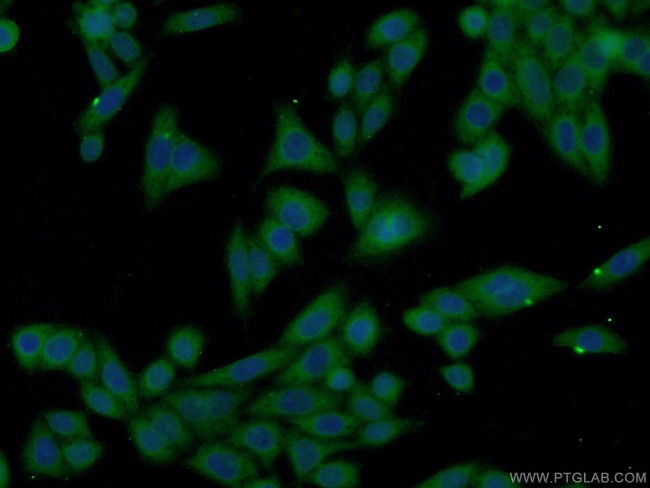 XRN1 Antibody in Immunocytochemistry (ICC/IF)