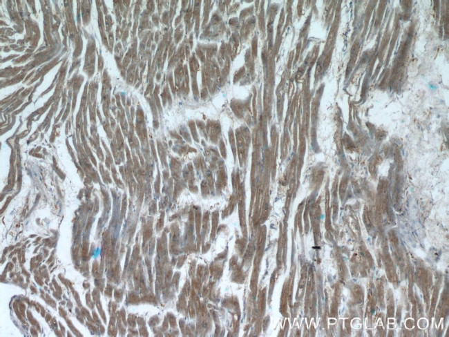 XRN1 Antibody in Immunohistochemistry (Paraffin) (IHC (P))