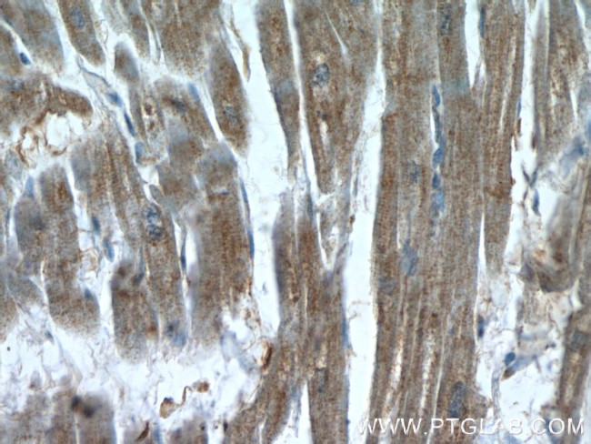 XRN1 Antibody in Immunohistochemistry (Paraffin) (IHC (P))