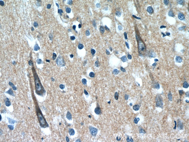 XRN1 Antibody in Immunohistochemistry (Paraffin) (IHC (P))