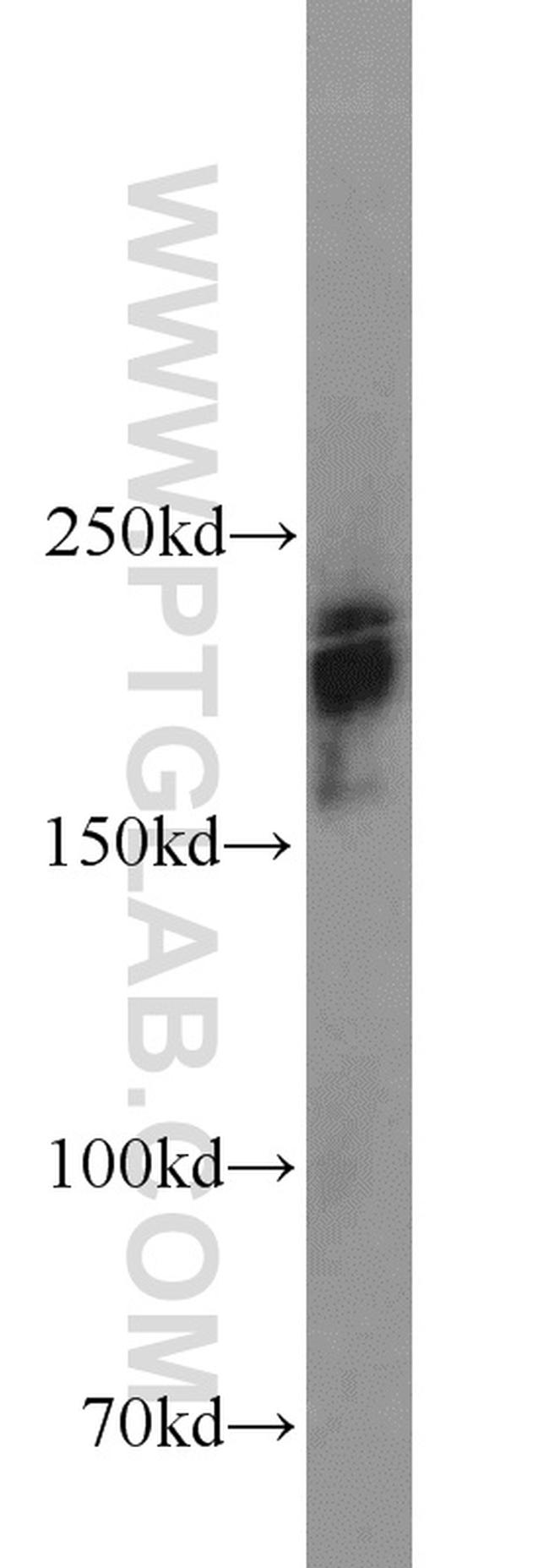 XRN1 Antibody in Western Blot (WB)